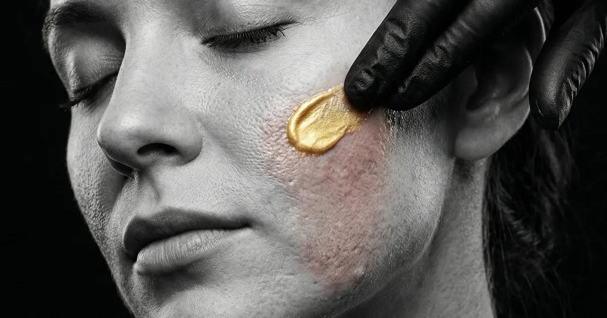 Granitos Después de Depilar la Cara con Cera: Causas y Cómo Tratarlos