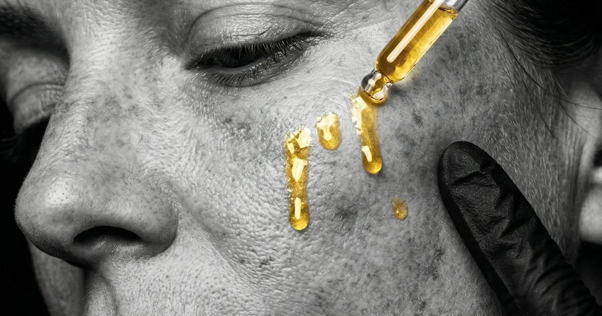 Reparar la Piel Después del Verano: Tratamientos Faciales para Septiembre